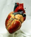 تزريق سلول‌هاي بنيادي به قلب و درمان دردهاي قفسه سينه( آنژين)