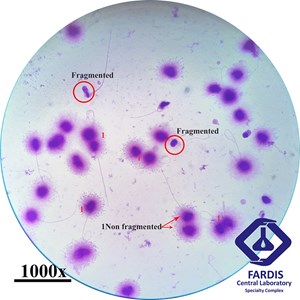  تست قطعه قطعه شدن DNA  اسپرم 