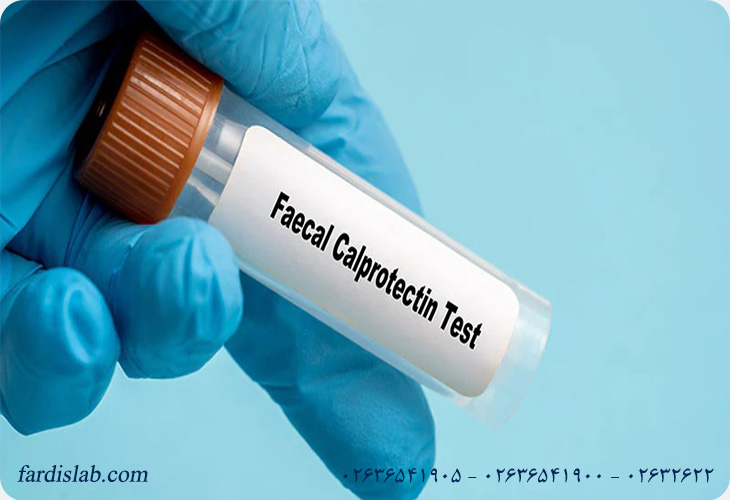 تفسیر آزمایش Calprotectin چگونه است؟ 