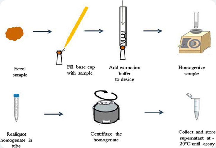مراحل انجام آزمایش Calprotectin 