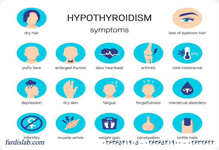 علائم بیماری هاشیموتو 