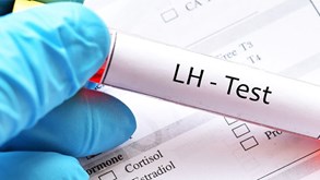آزمایش LH چیست؟