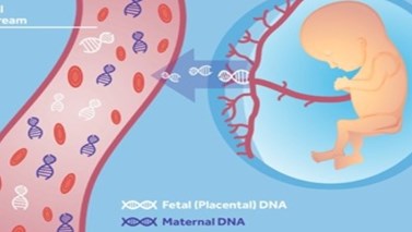 تست NIPT  چیست و در چند هفتگی انجام می‌شود؟