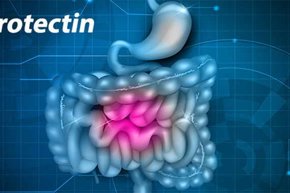 Calprotectin