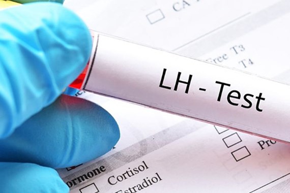 آزمایش LH چیست؟