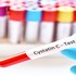 آزمایش Cystatin c چیست؟ 