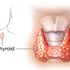 علائم بیماری هاشیموتو چیست؟