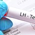 آزمایش LH چیست؟
