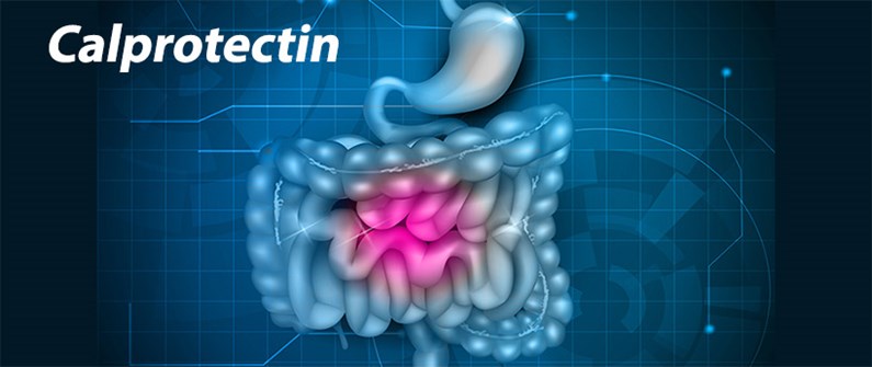 Calprotectin