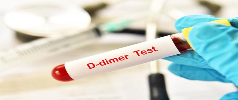 آزمایش دی دایمر(D-Dimer) چیست؟