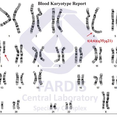 (6;4)Translocation